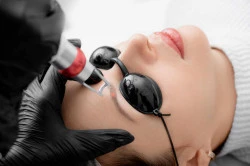 Quel institut choisir pour un peeling  