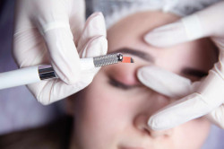 Prix d'une dermopigmentation   